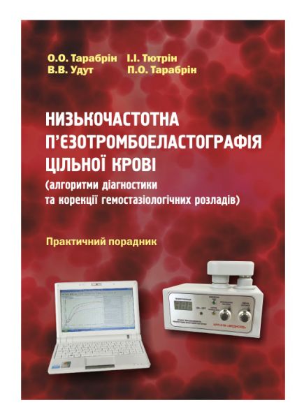 Низькочастотна п’єзотромбоеластографія цільної крові (алгоритми діагностики та корекції гемостазіологічних розладів)